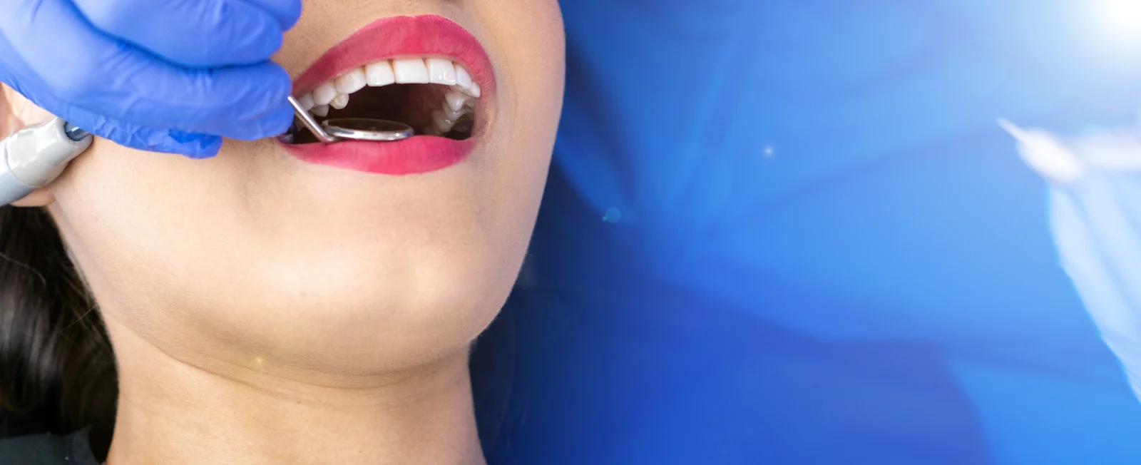 Teeth Cleaning